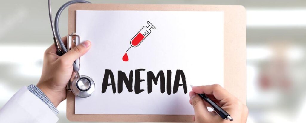 Anemia - objawy, przyczyny, rodzaje i leczenie