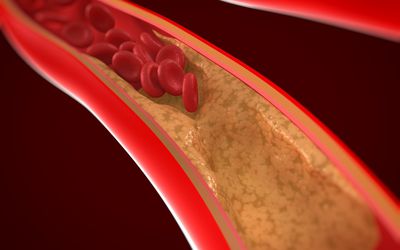 Przyczyny niskiego ciśnienia krwi
