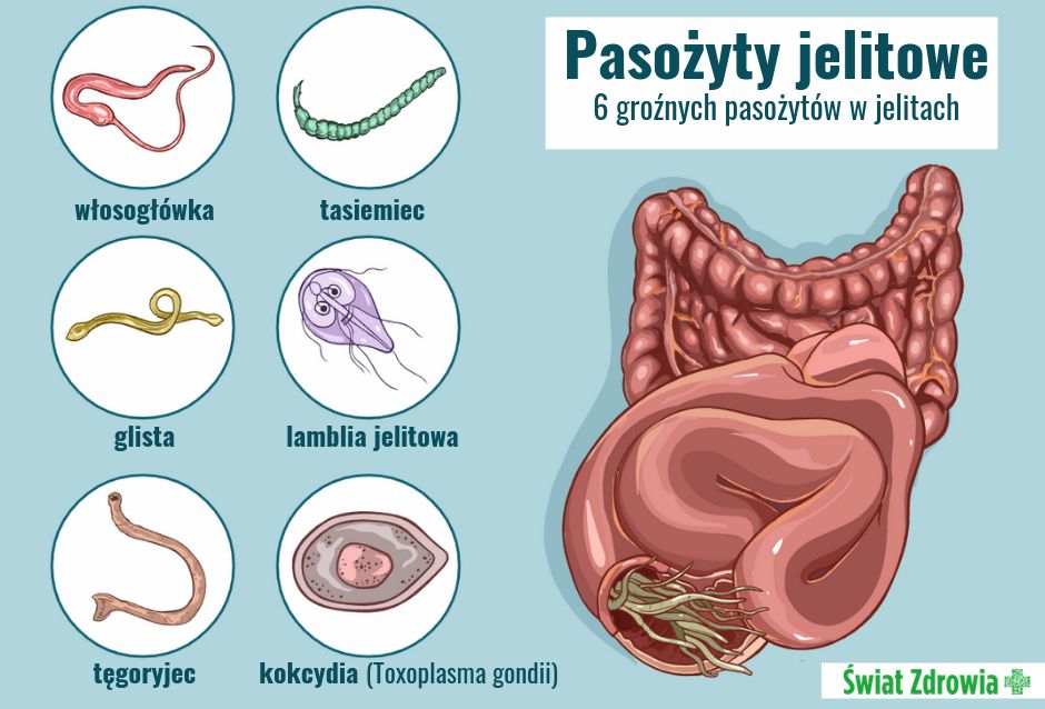 Pasożytnicze zakażenia jelitowe - objawy, przyczyny, leczenie