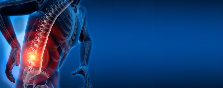 Artroza: objawy, przyczyny, diagnoza i leczenie